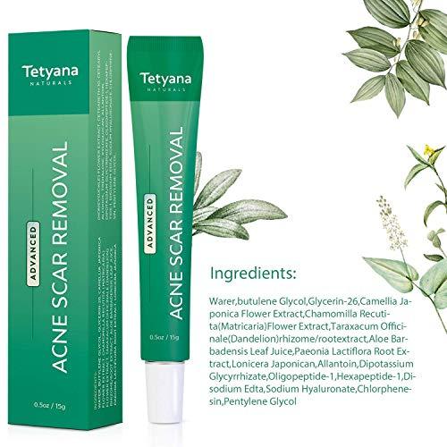 Tetyana naturals Scar Gel, Acne Scar Removal for Face & Body Old & New Scars - 15g